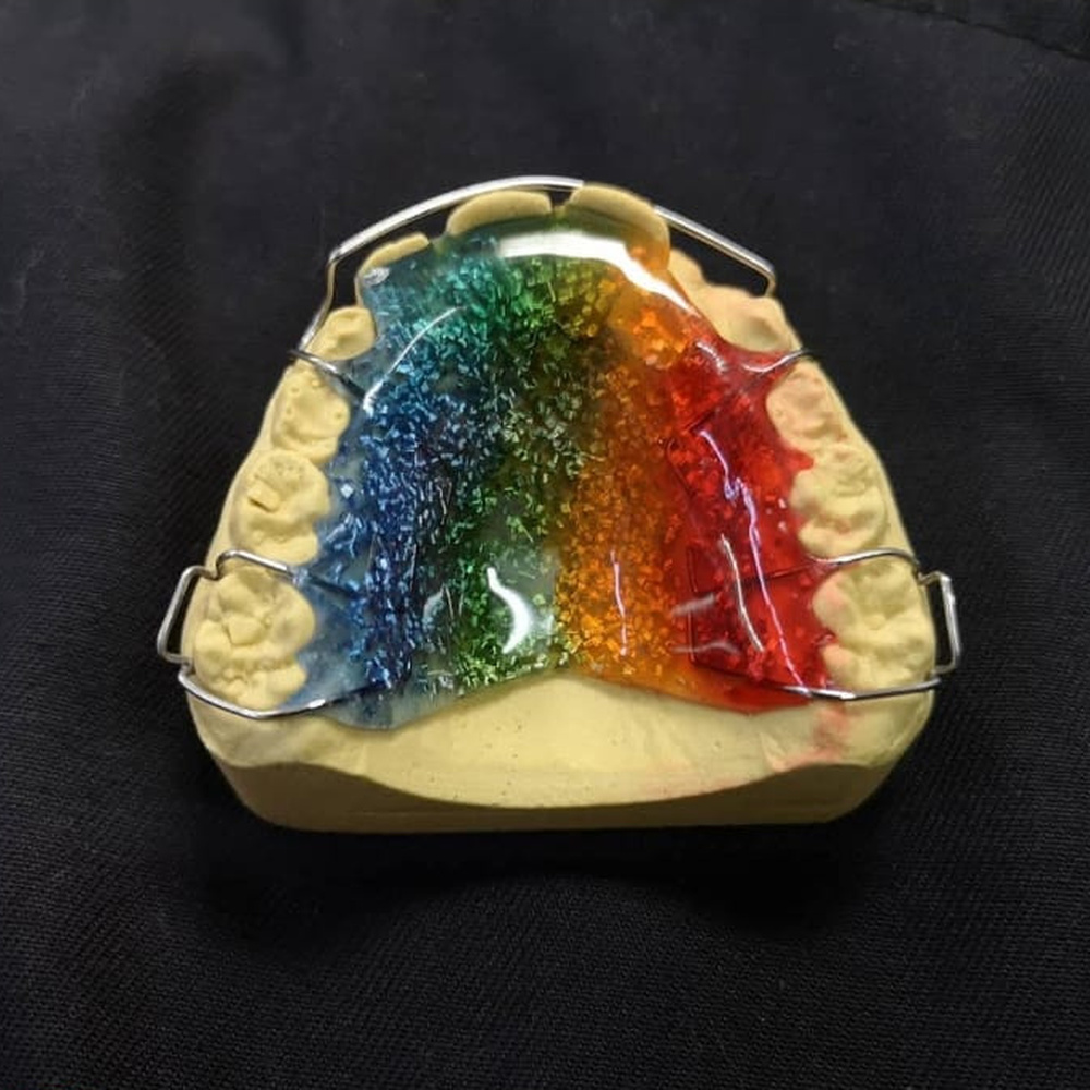 Colourful removable orthodontic appliance on a dental cast