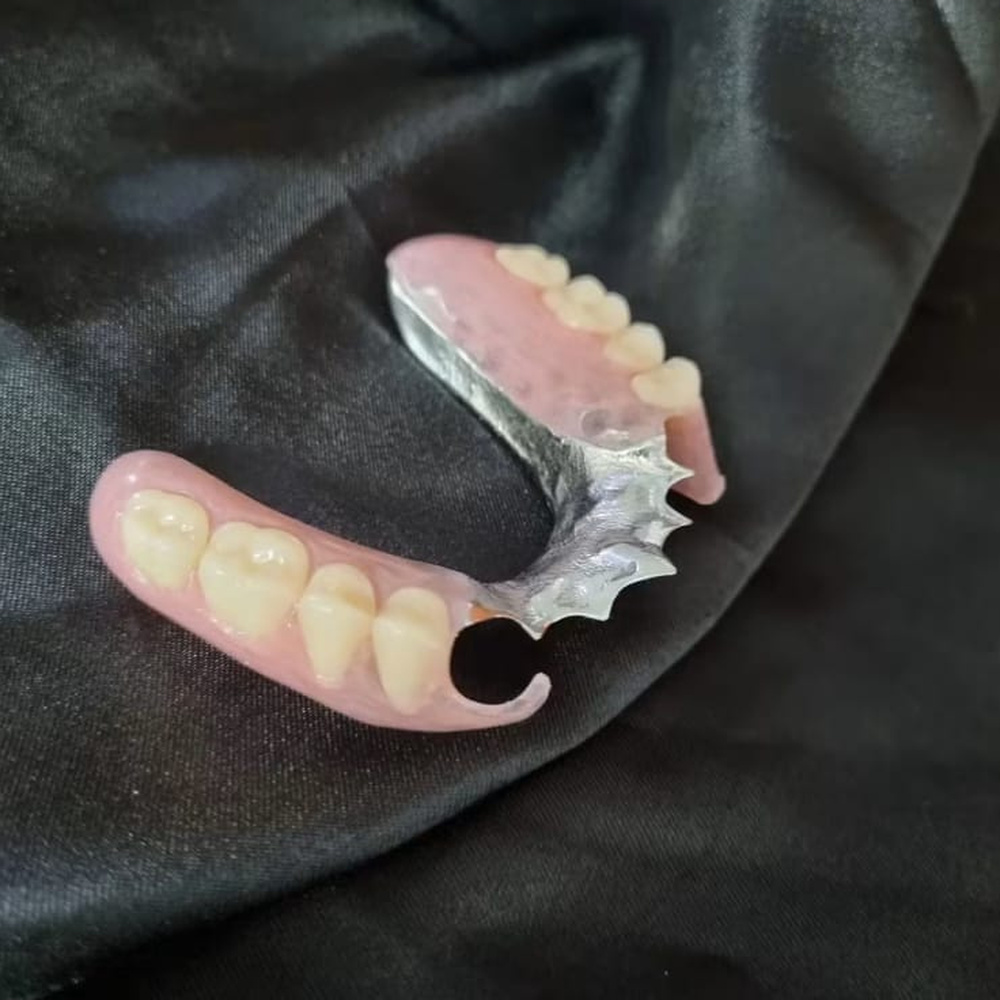 Chrome and acrylic combination denture on black fabric