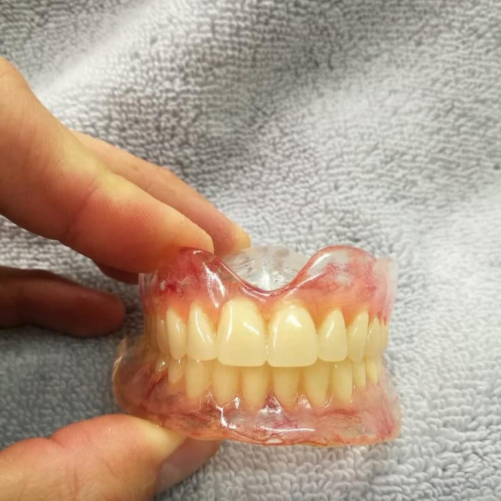 Clear acrylic full denture held against a neutral cloth background