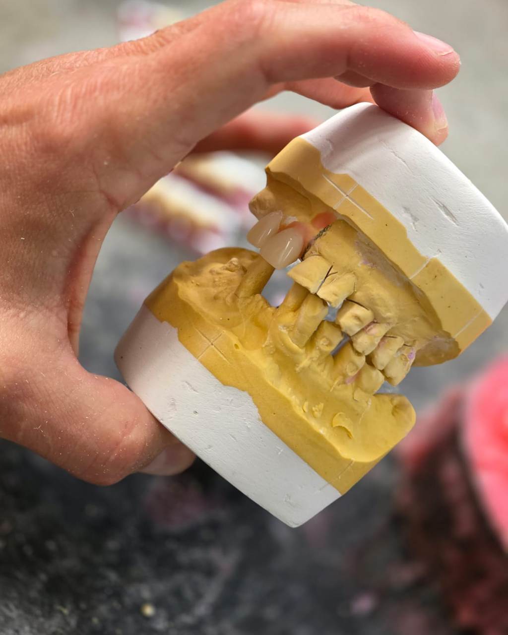 Anton Vorster shaping a denture setup at the laboratory bench