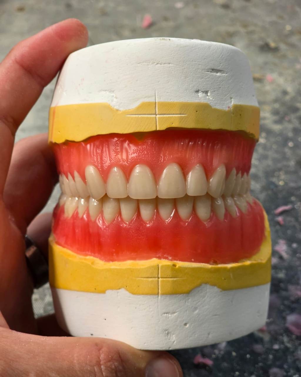 A complete upper and lower denture finished on the articulator