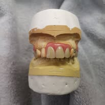 Anterior case