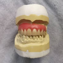 Full denture